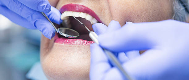Best Chipped Tooth Repair Near Me  in University Park, MD